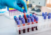 Ebola Vaccine Using SHOCK Ingredient! Gloved hand handling blood samples in a laboratory.